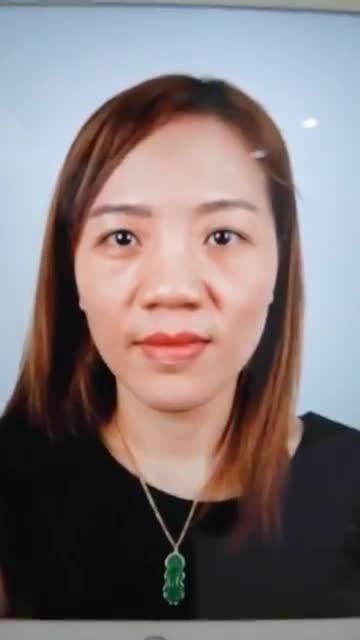 KHÁCH HÀNG CẮT MÍ MẮT + NÂNG MŨI CẤU TRÚC TẠI SAIGON STAR BÁC SĨ HOẠT