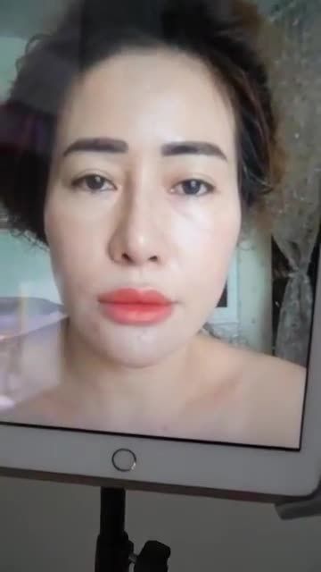 KHÁCH HÀNG THỰC TẾ SAU 1 THÁNG NÂNG MŨI CẤU TRÚC SỬA LẠI ĐẾN TÁI KHÁM