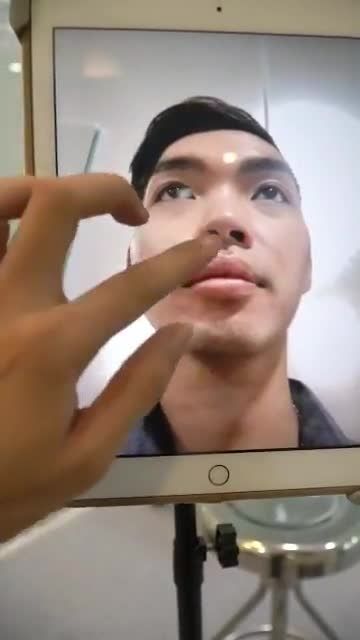 SAU 45P NÂNG MŨI CẤU TRÚC – MŨI CAO CHUẨN NAM TÍNH, KHÔNG SƯNG BẦM