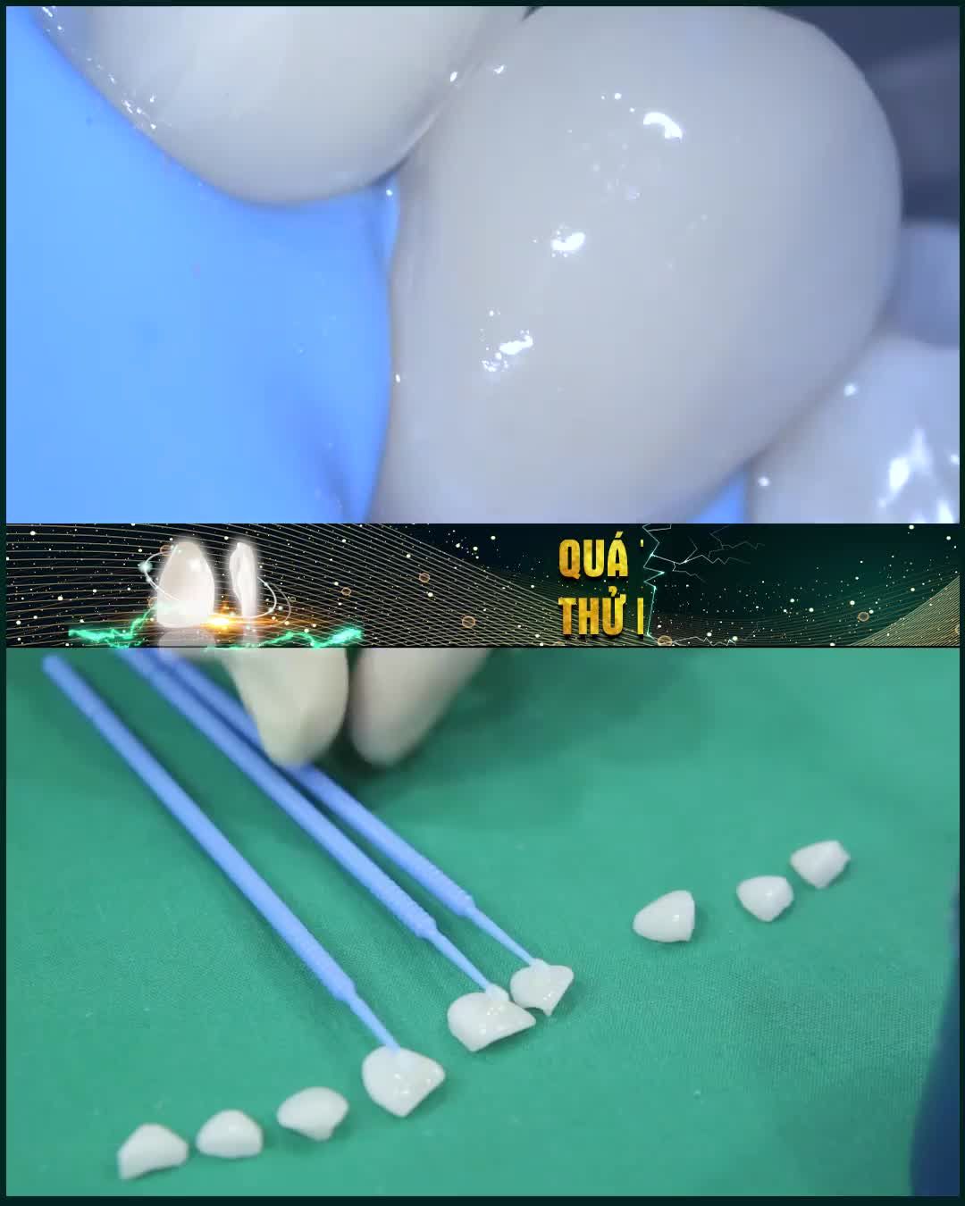 Bùng nổ:DÁN SỨ VENEER ULTRATHIN CHỈ TỪ 3 TR/ RĂNG