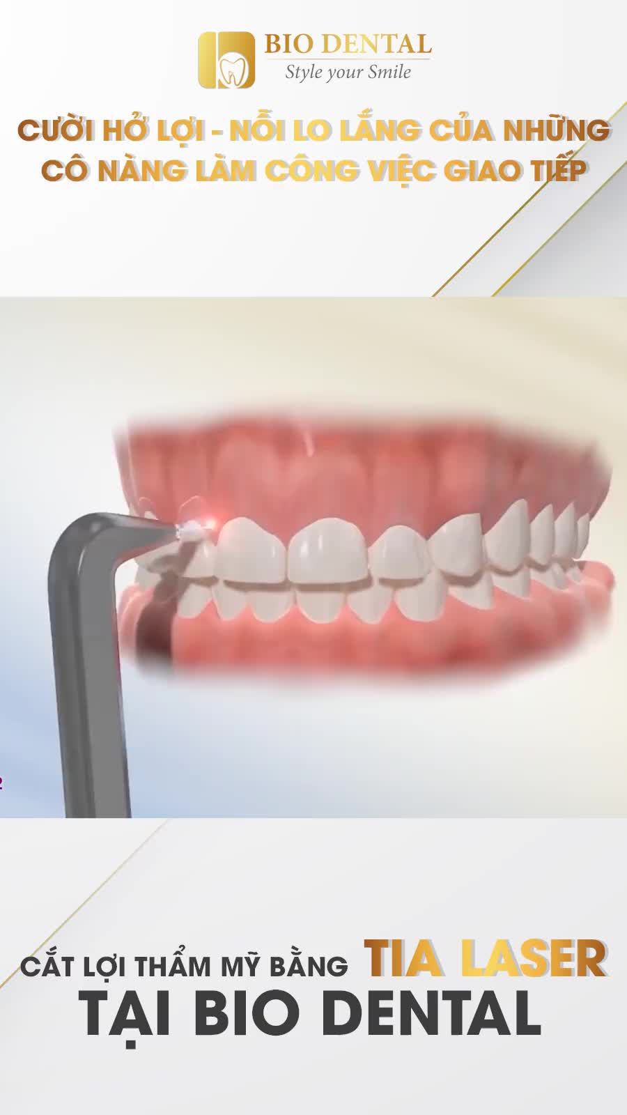 CƯỜI HỞ LỢI - NỖI LO LẮNG CỦA NHỮNG CÔ NÀNG LÀM CÔNG VIỆC GIAO TIẾP