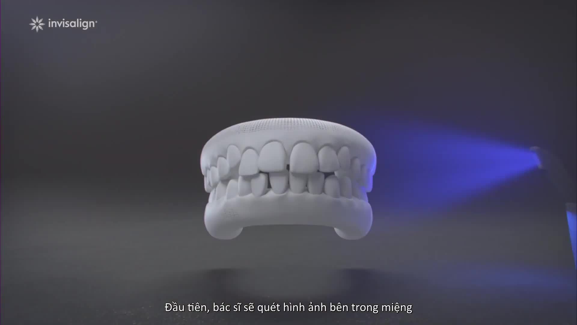 SỰ KHÁC BIỆT TẠO NÊN ĐẲNG CẤP CỦA INVISALIGN