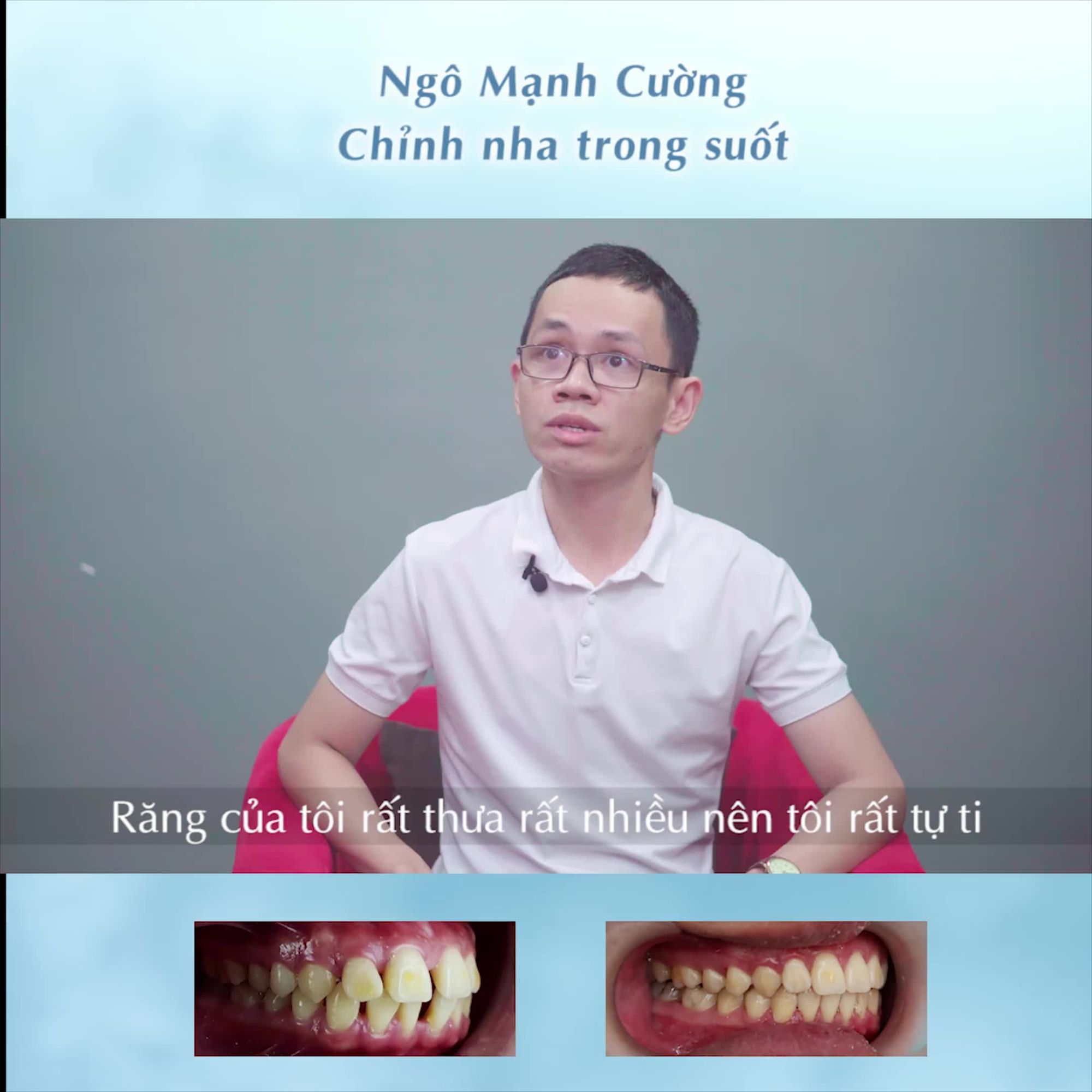 TÌM HIỂU VỀ PHƯƠNG PHÁP CHỈNH NHA TRONG SUỐT – TÔI QUYẾT ĐỊNH CHỌN SHINBI