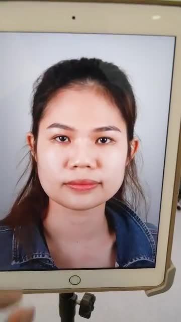 NÂNG MŨI CẤU TRÚC VỪA THỰC HIỆN XONG