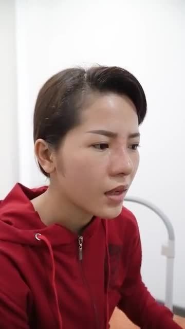 MŨI ĐẸP NGAY VỚI KẾT QUẢ SAU 10 NGÀY NÂNG MŨI CẤU TRÚC SỬA LẠI