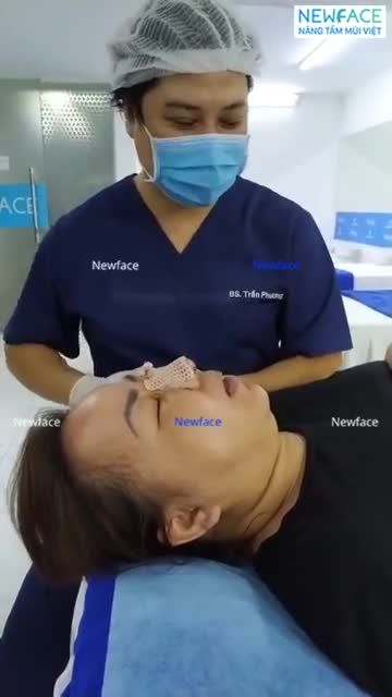 BÁC SĨ TRỰC TIẾP THÁO NẸP VÀ PHỎNG VẤN NHANH CHỊ KHÁCH VIỆT KIỀU MỸ VỀ DỊCH VỤ Ở NEWFACE