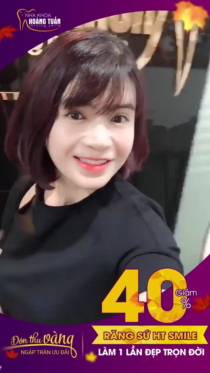 THAY ĐỔI THẦN THÁI SAU THẨM MỸ RĂNG SỨ