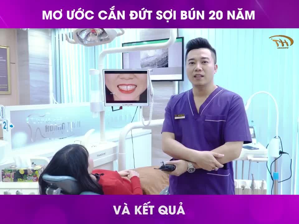 Kết quả Thẩm mỹ 16 răng sứ khách hàng Việt Kiều Đài Loan
