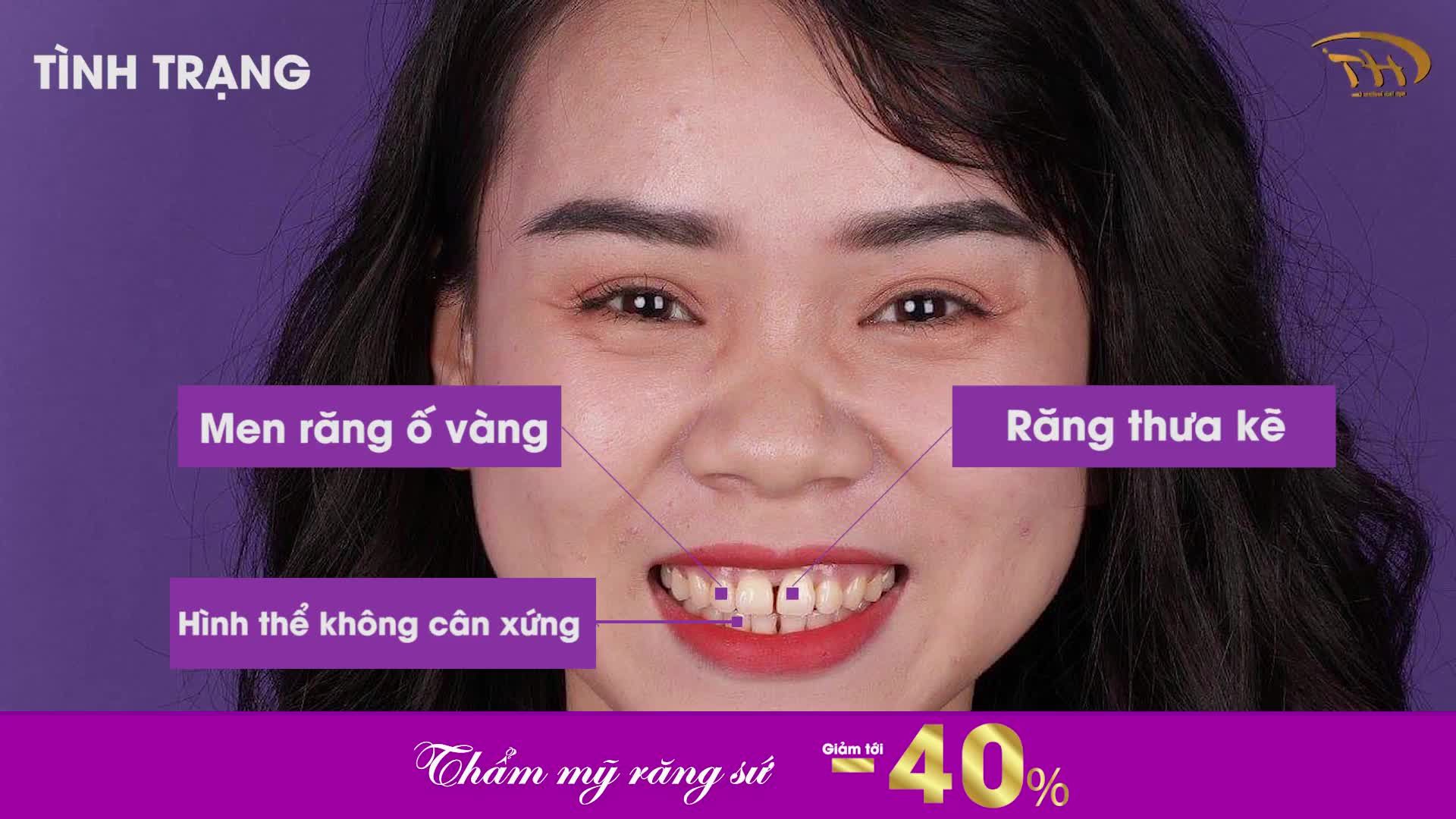 Duy nhất 2 ngày cuối cùng giảm 40%