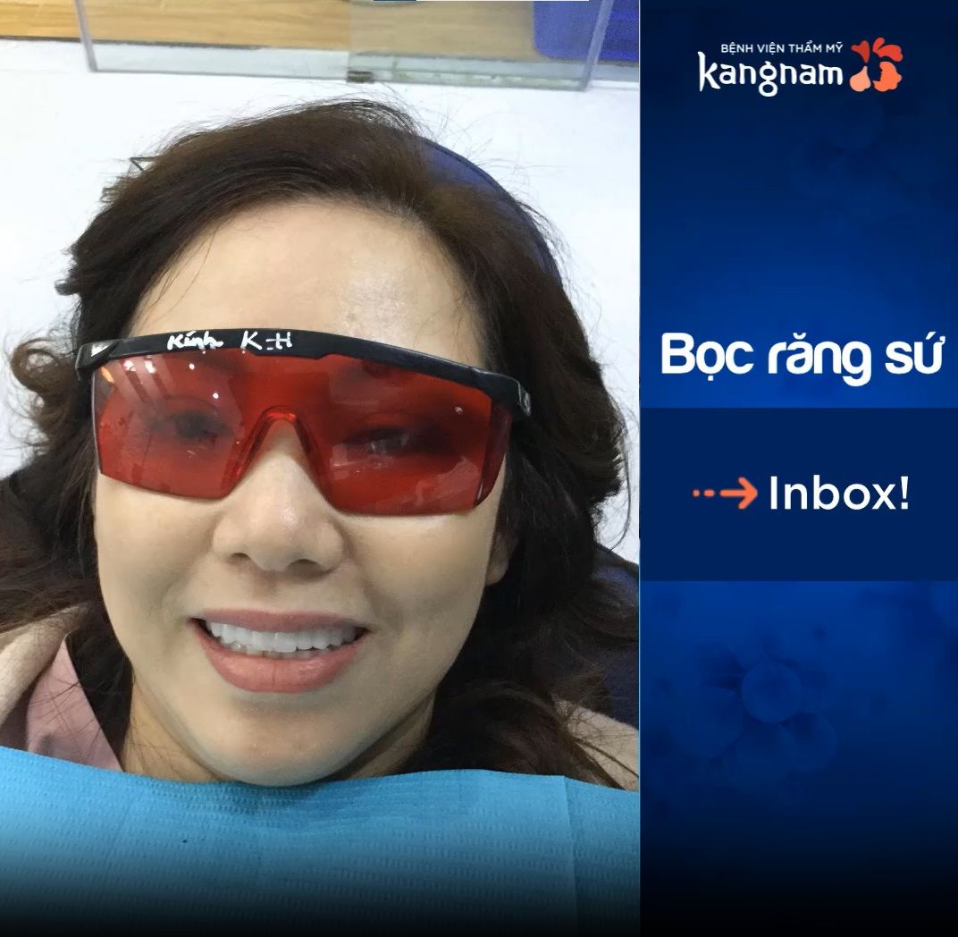 Bọc Răng Sứ chuẩn Hàn tại Kangnam