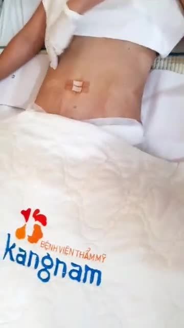 Vòng 2 ĐẸP XUẤT SẮC sau Tạo hình Body Sline