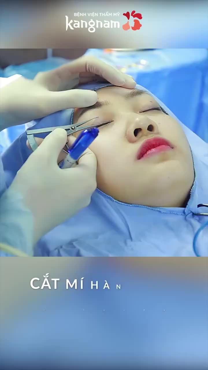 LOẠI BỎ KHUYẾT ĐIỂM MẮT - TỰ TIN MẮT ĐẸP XUẤT THẦN SAU 5 NGÀY