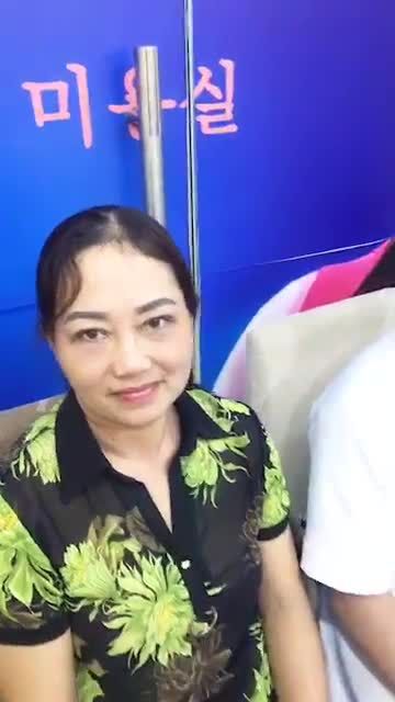 Khách hàng tái khám cắt mí mắt trên sau 1 tháng