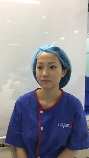 Bấm mí tại Bệnh viện thẩm mỹ kangnam Hà Nội