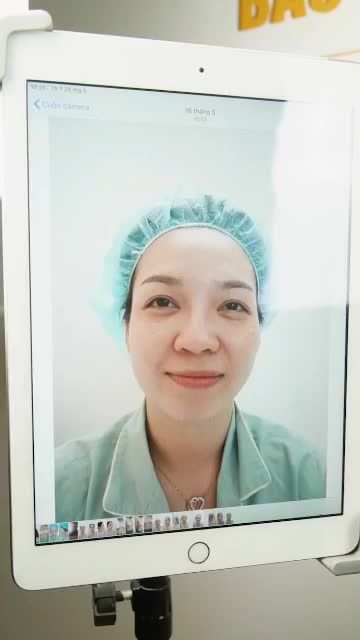 CÔ GÁI XINH ĐẸP RẠNG NGỜI SAU 2 TUẦN NÂNG MŨI CẤU TRÚC