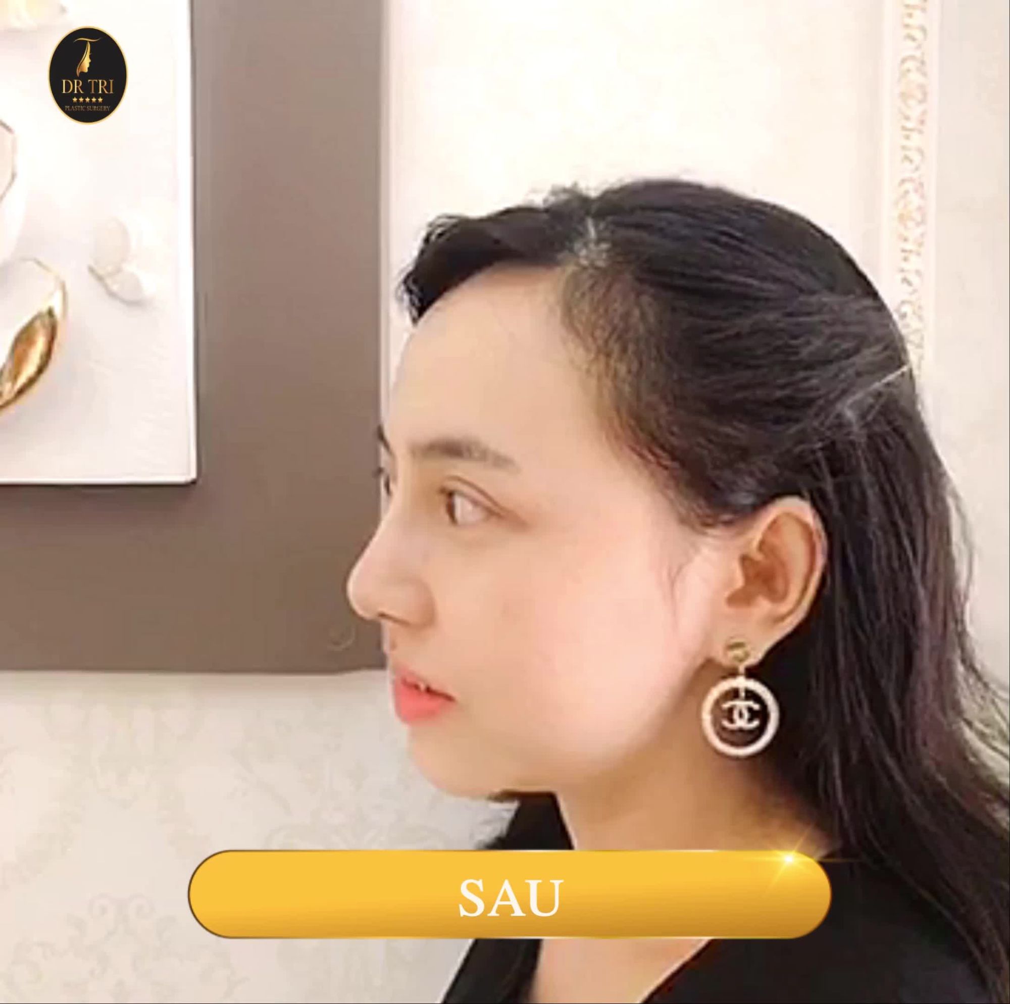 Đã là phụ nữ, nhất định phải đẹp rạng ngời ở tuổi đôi mươi, quyến rũ ở tuổi ba mươi và rực rỡ suốt quãng đời còn lại.