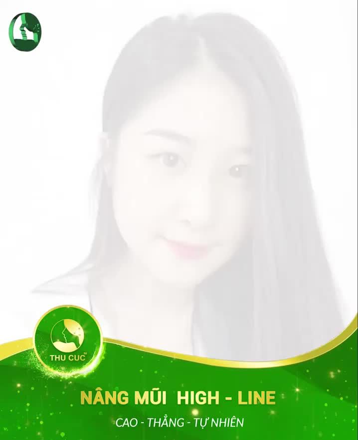 Dáng mũi cao sang sẽ làm chị em thêm TỰ TIN thể hiện cá tính.