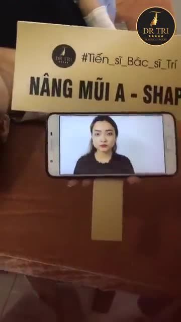 Kết quả sau phẫu thuật tạo hình mũi A_Shape và tạo_hình_mí_trên của khách hàng tại Dr_Trí!