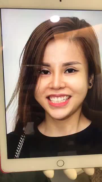 SỞ HỮU NỤ CƯỜI CHUẨN HOTGIRL CHỈ SAU 2 NGÀY thẩm mỹ 20 răng sứ HT Smile