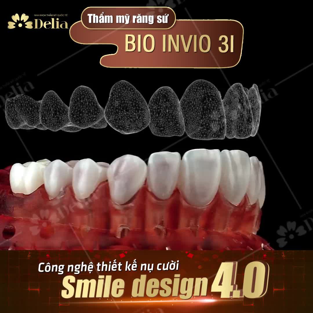 Biến đổi ngoạn mục chỉ sau 48H với công nghệ Thẩm mỹ răng sứ Bio Invio 3I