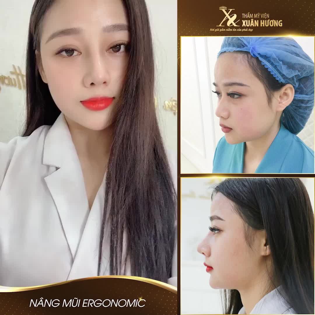 ĐỊNH NGHĨA HOÀN HẢO CHO CHIẾC MŨI "ĐẸP MỌI GÓC NHÌN" LÀ ĐÂY!