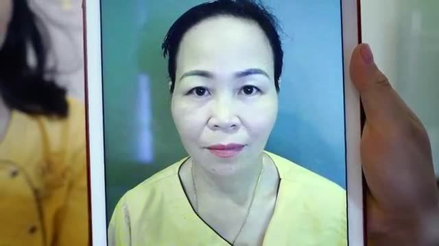 Độ tuổi nào nên nâng cung mày để khắc phục sụp mí da chùng? Theo dõi video để hiểu rõ hơn nhé!