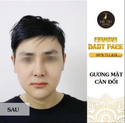 COMBO BABY FACE - ĐỔI THAY TOÀN DIỆN