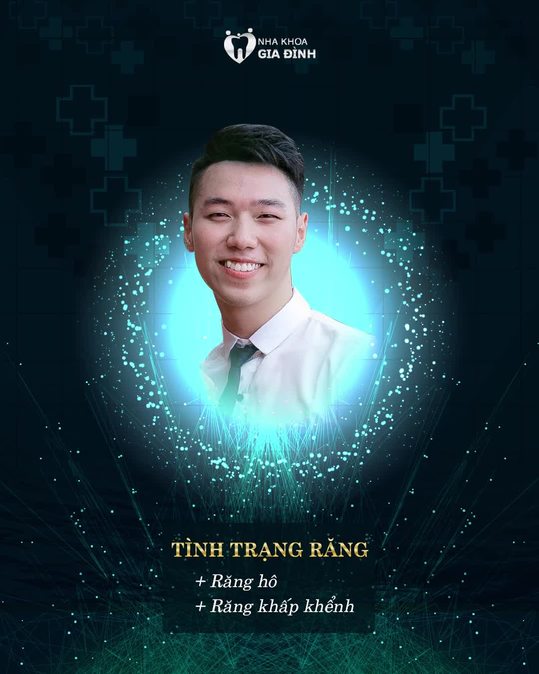 SỞ HỮU NỤ CƯỜI "NAM THẦN" NHỜ NIỀNG RĂNG CHỈNH NHA