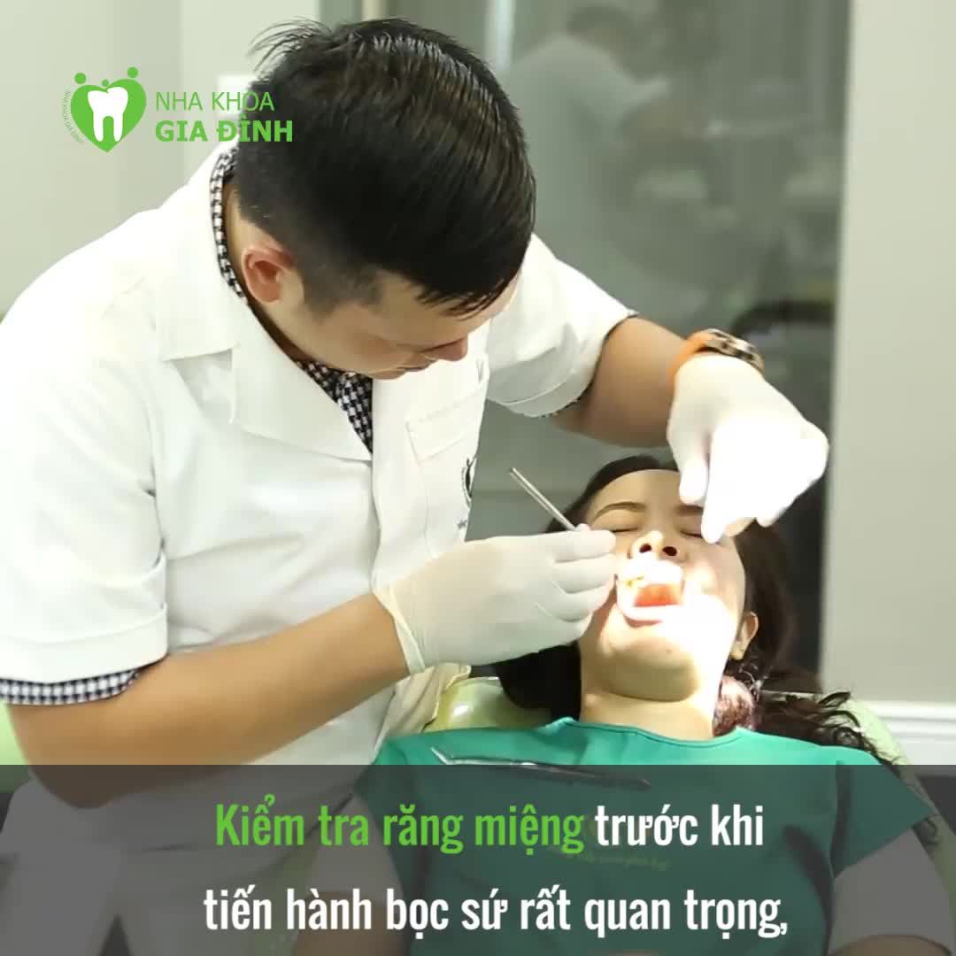 5 LƯU Ý TRƯỚC KHI QUYẾT ĐỊNH LÀM RĂNG THẨM MỸ