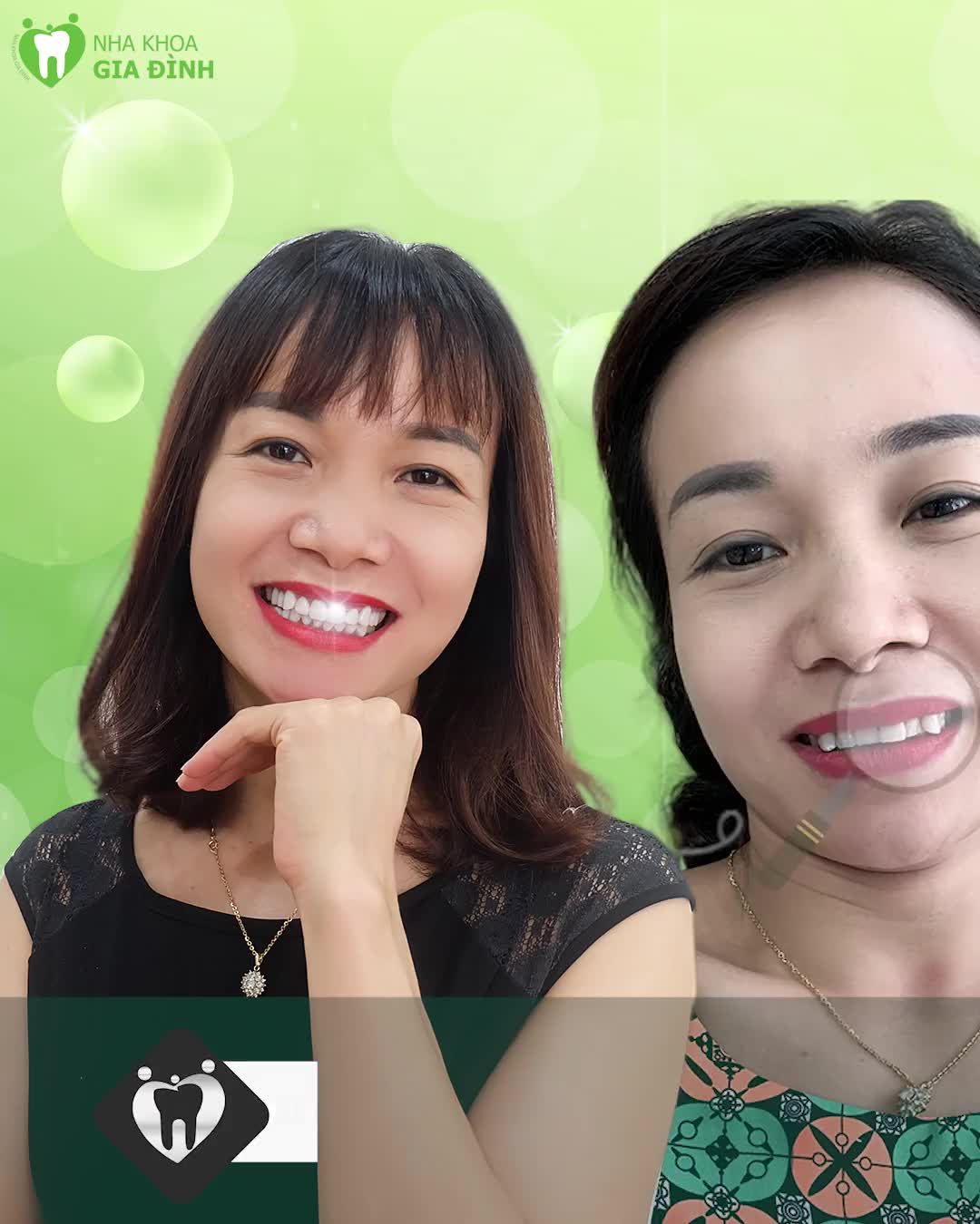 LÀM RĂNG SỨ CÓ ĐAU KHÔNG