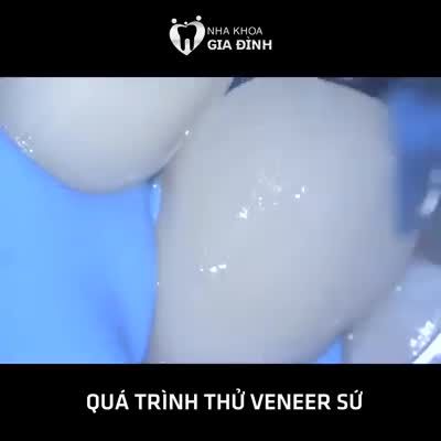Khoảnh khắc mong đợi - ƯỚM THỬ VENEER ULTRATHIN