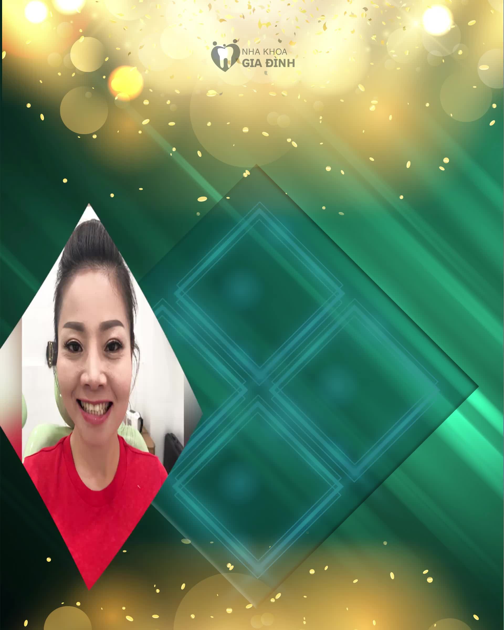 DÁN SỨ VENEER – GIẢI PHÁP HOÀN HẢO CHO NỤ CƯỜI CỦA BẠN