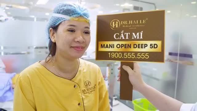Gần 30 năm sở hữu đôi mắt bên to bên nhỏ, tự ti lắm nhưng chưa có can đảm thẩm mỹ - Khi có can đảm làm lại bất ngờ biết thế làm mí sớm hơn