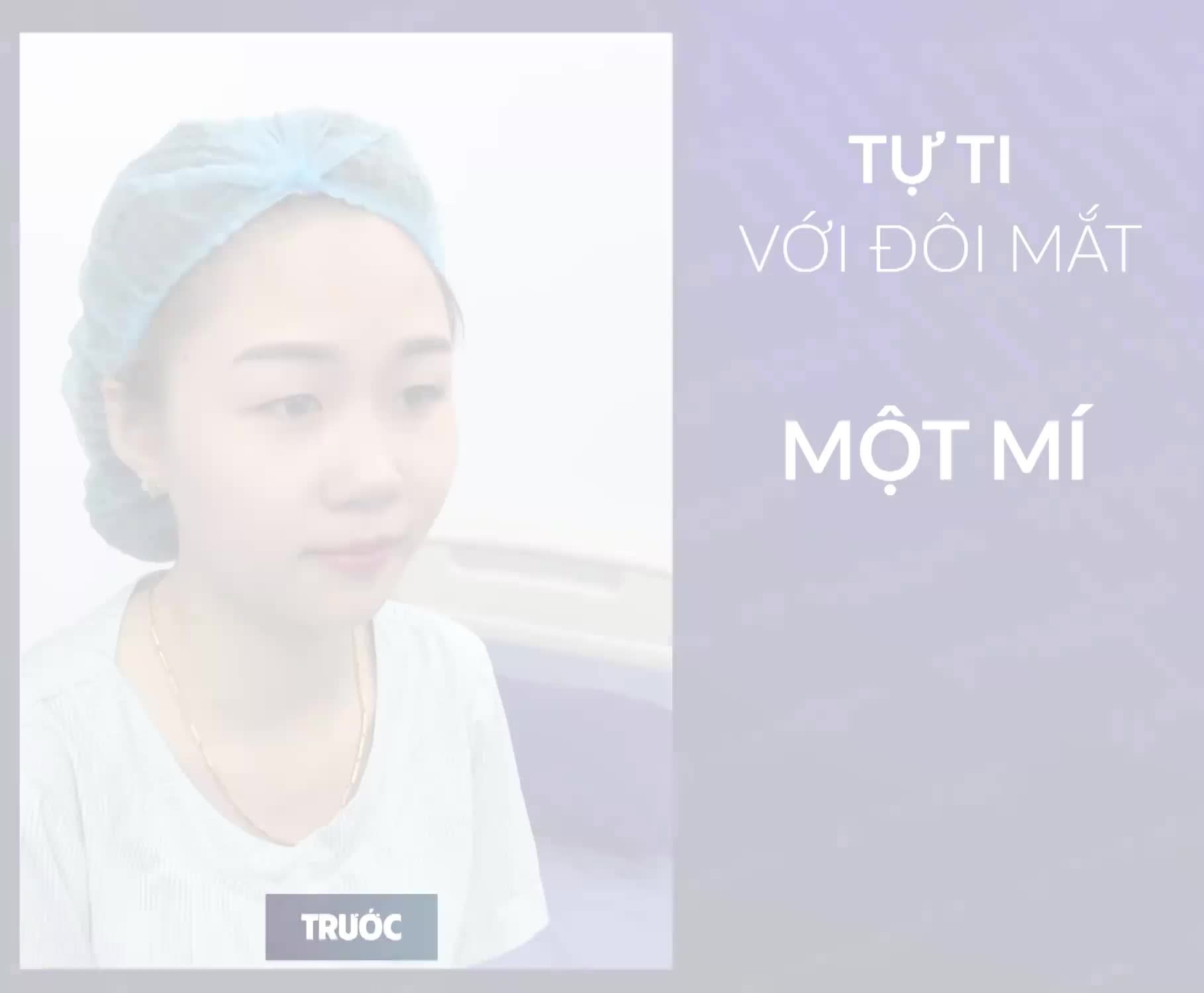 KHÁCH HÀNG NÓI GÌ SAU 5 NGÀY CẮT MÍ BABY EYES 6D