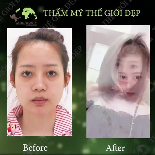 Mỗi ngày một MÓN_QUÀ thật đặc biệt từ quý Khách Hàng dành cho Bác sĩ và đội ngũ nhân viên tại Thế_Giới_Đẹp thêm cố gắng.