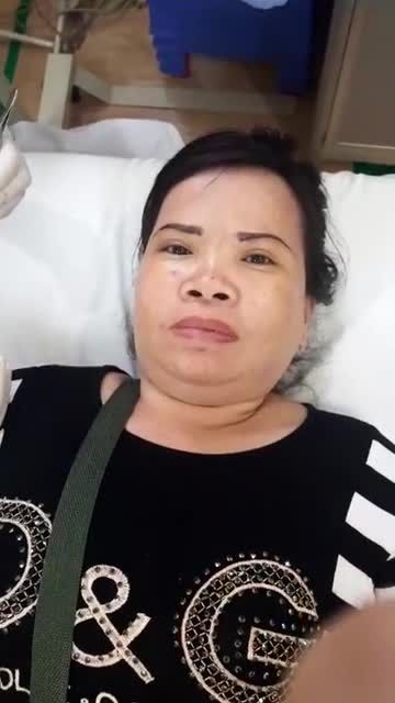 NÂNG CUNG MÀY sau 7 ngày? Kết quả ra sao?