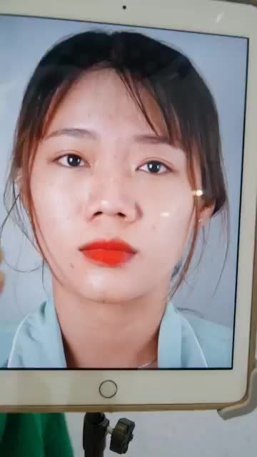 NÂNG MŨI CẤU TRÚC - - LOẠI BỎ NGAY TÌNH TRẠNG MŨI NGẮN, HẾCH, TẸT