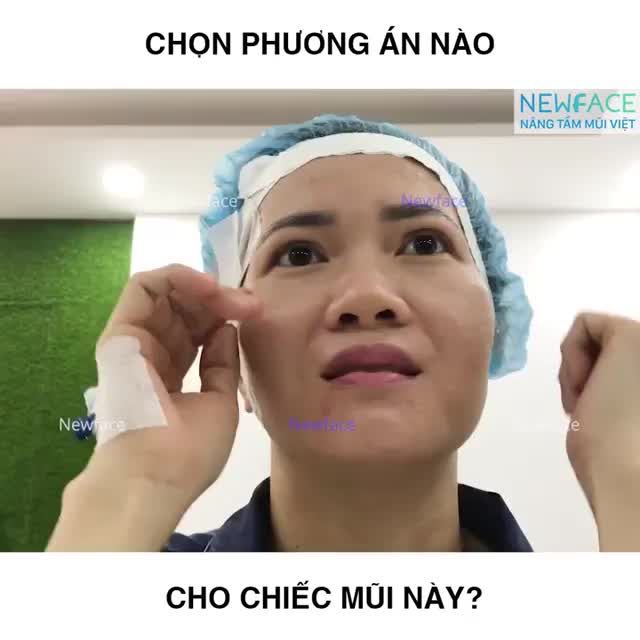 NÂNG MŨI - CHỌN PHƯƠNG PHÁP NÀO CHO PHÙ HỢP?