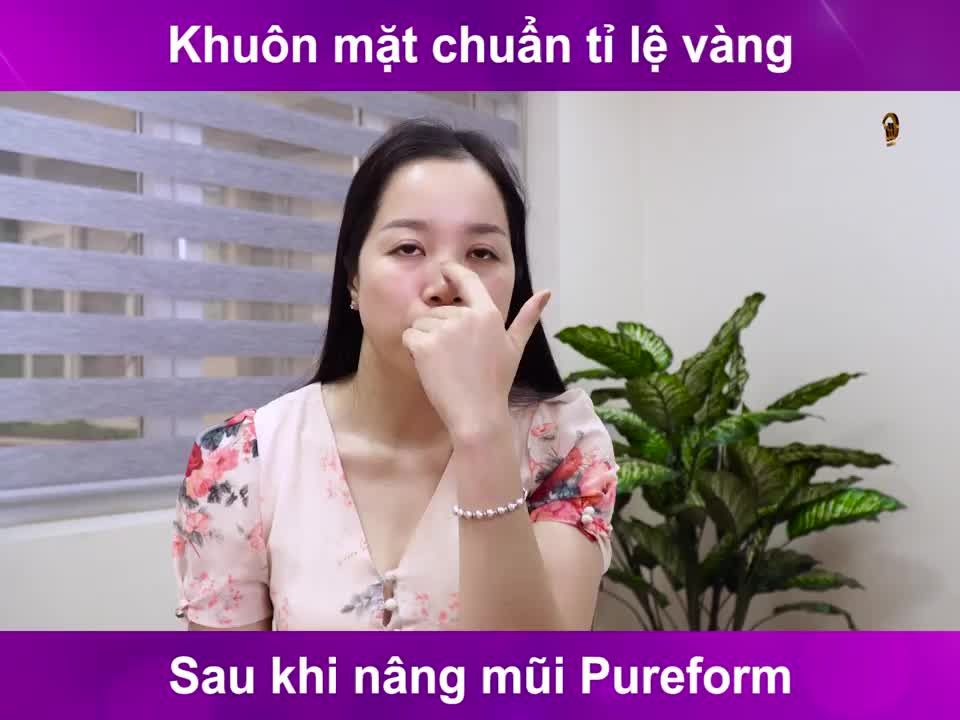 Khuôn mặt chuẩn tỷ lệ vàng ngay sau khi nâng mũi Purform HT