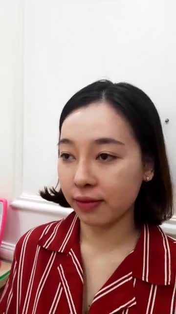 Tái khám sau 3 THÁNG Nâng mũi Cấu trúc 4D kết hợp Cắt cánh mũi