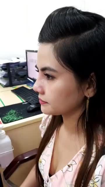 Khách hàng nâng mũi Sline 4D