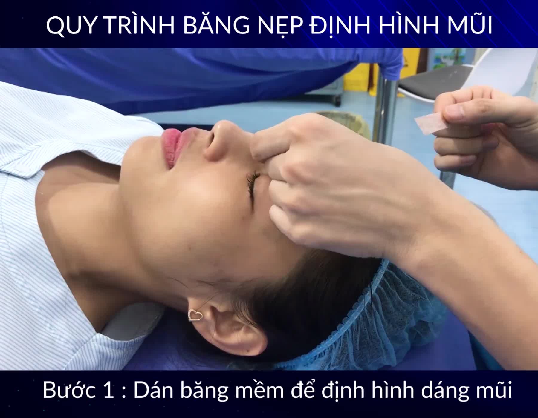 Quy trình Bác sĩ thực hiện băng nẹp mũi cho Khách hàng sau khi Nâng mũi