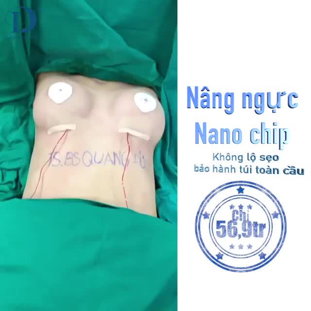 TÂN TRANG V1- CHỈ 56TR9 TÚI ERGONOMIX