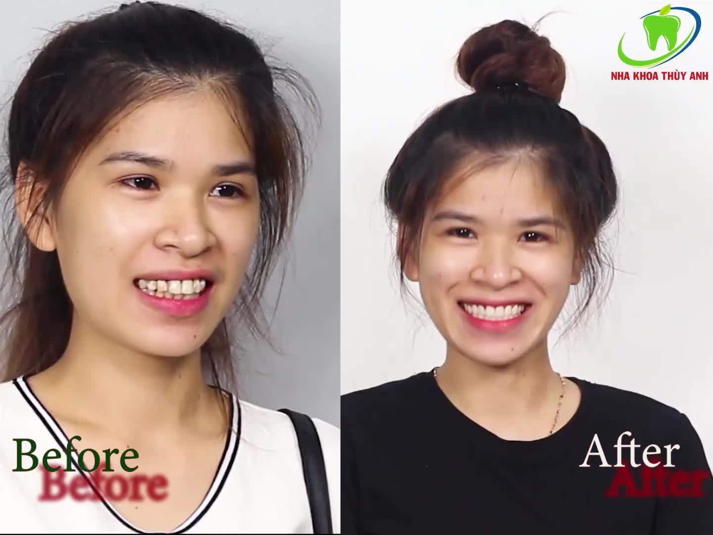 NHA KHOA THÙY ANH - NƠI NÍU GIỮ THANH XUÂN