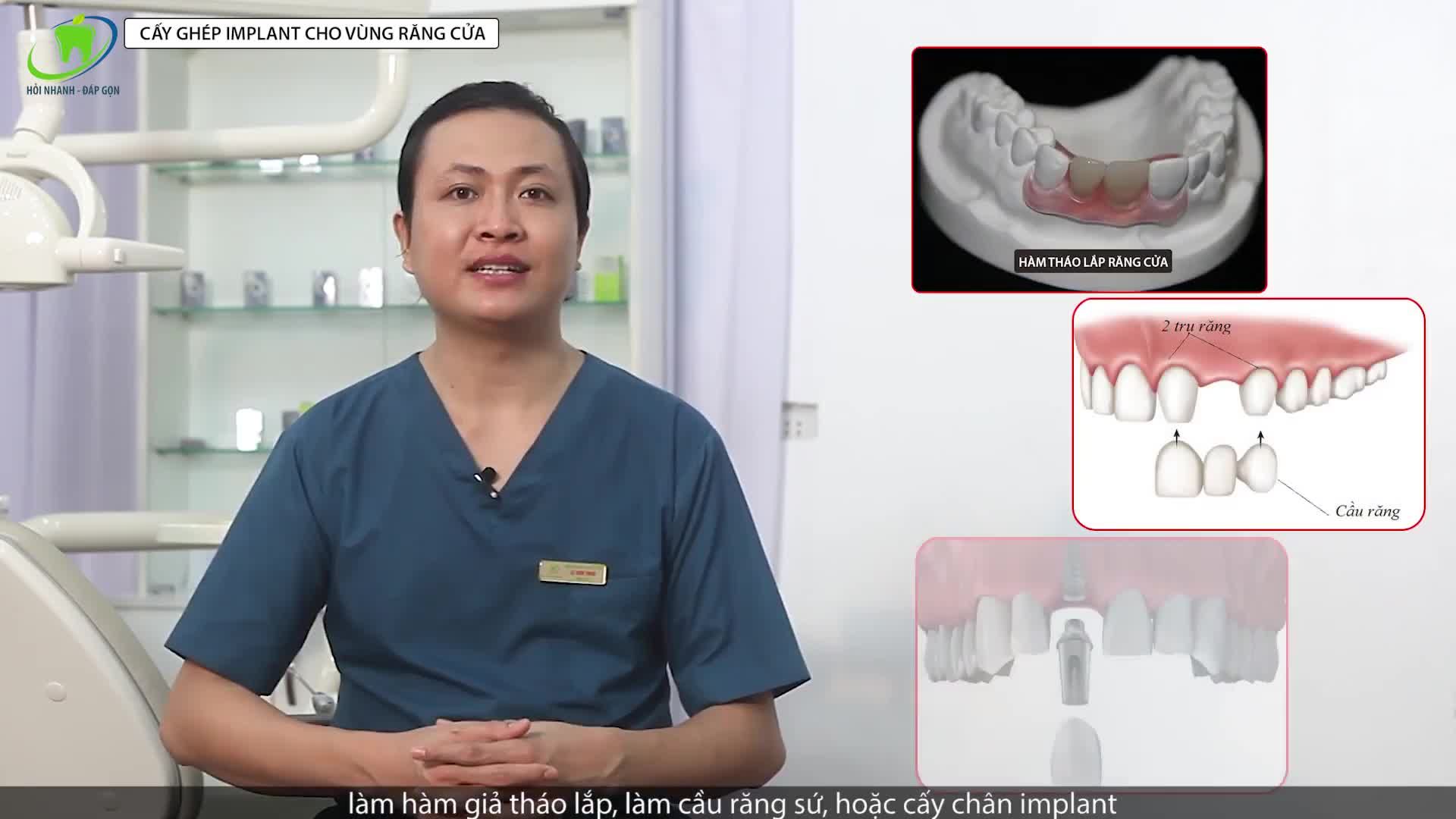 CẤY IMPLANT RĂNG CỬA CÓ CHI PHÍ VÀ THỰC HIỆN RA SAO