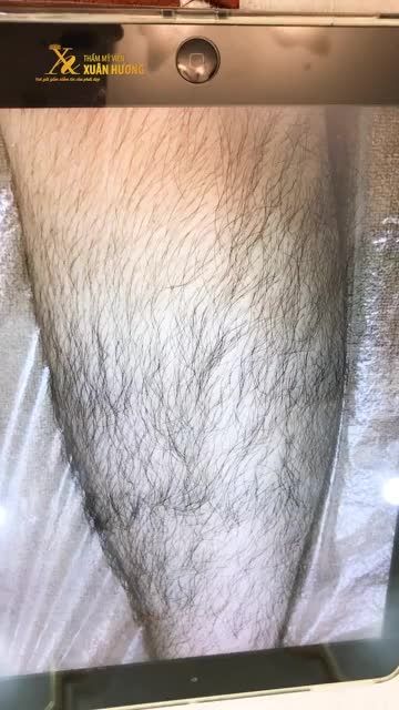 TIN ĐƯỢC KHÔNG ĐÂY LÀ ĐÔI CHÂN PHỤ NỮ ÁM ẢNH LÔNG CHÂN VỪA DÀY VỪA DÀI - CÔ GÁI ĐẾN NGAY TMV XUÂN HƯƠNG TRIỆT LÔNG