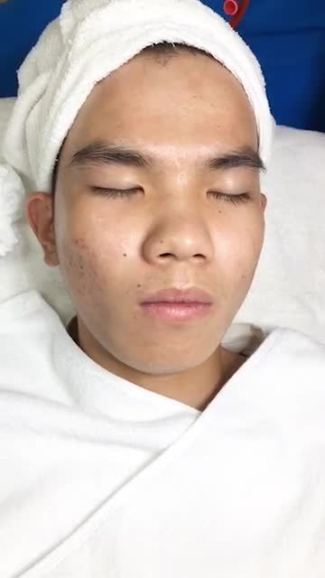 QUÁ ĐÃ! Trị mụn chỉ 1.000Đ Từ 16 - 22/9