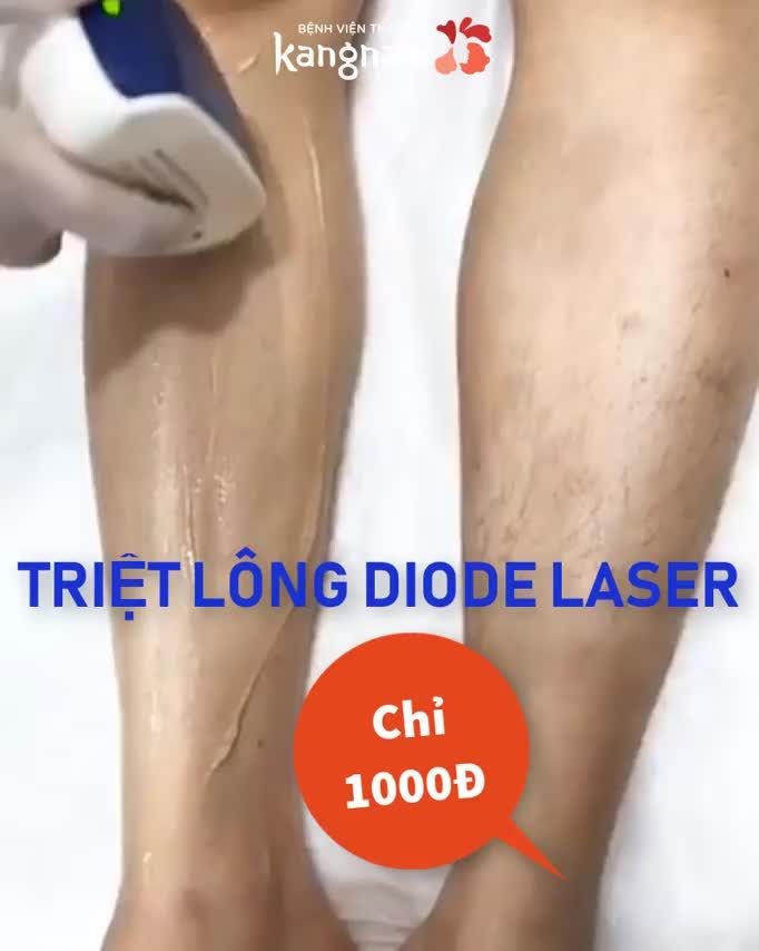 CHỚP THỜI CƠ | Sạch lông chỉ với 1.000Đ
