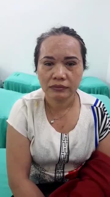 Trực tiếp ca phẫu thuật treo mày bấm mí cho vị khách hàng 53 tuổi Giúp khách hàng trẻ hơn so với độ tuổi thực tế của mình