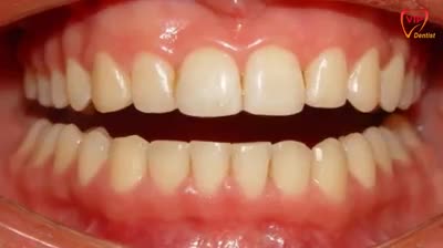??Ắ? ??Ụ? ??À? ??À? ?Ì?? ??Ạ?? ??Ớ? ?Ắ? ?Â? ??Ỉ ?? ??Á??
Khách hàng Phương Lan, 23 tuổi, đến từ Hà Nội